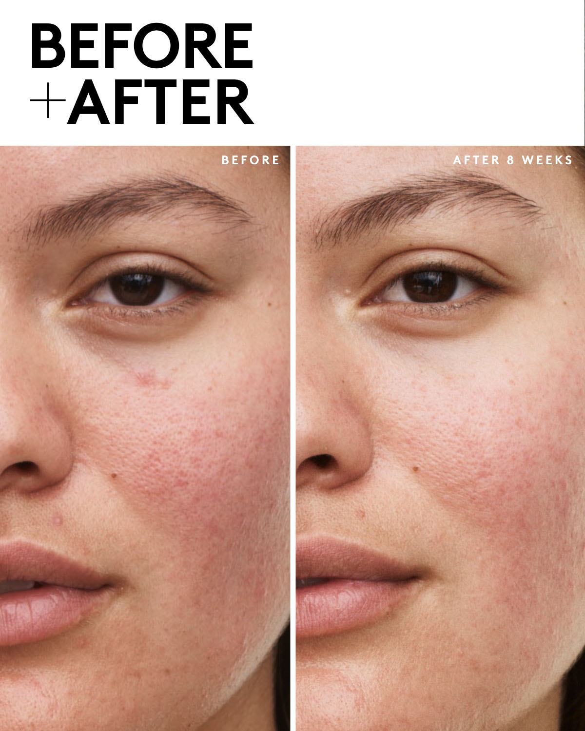 Fenty Skin Vault 5-Piece AM + PM Skincare Essentials