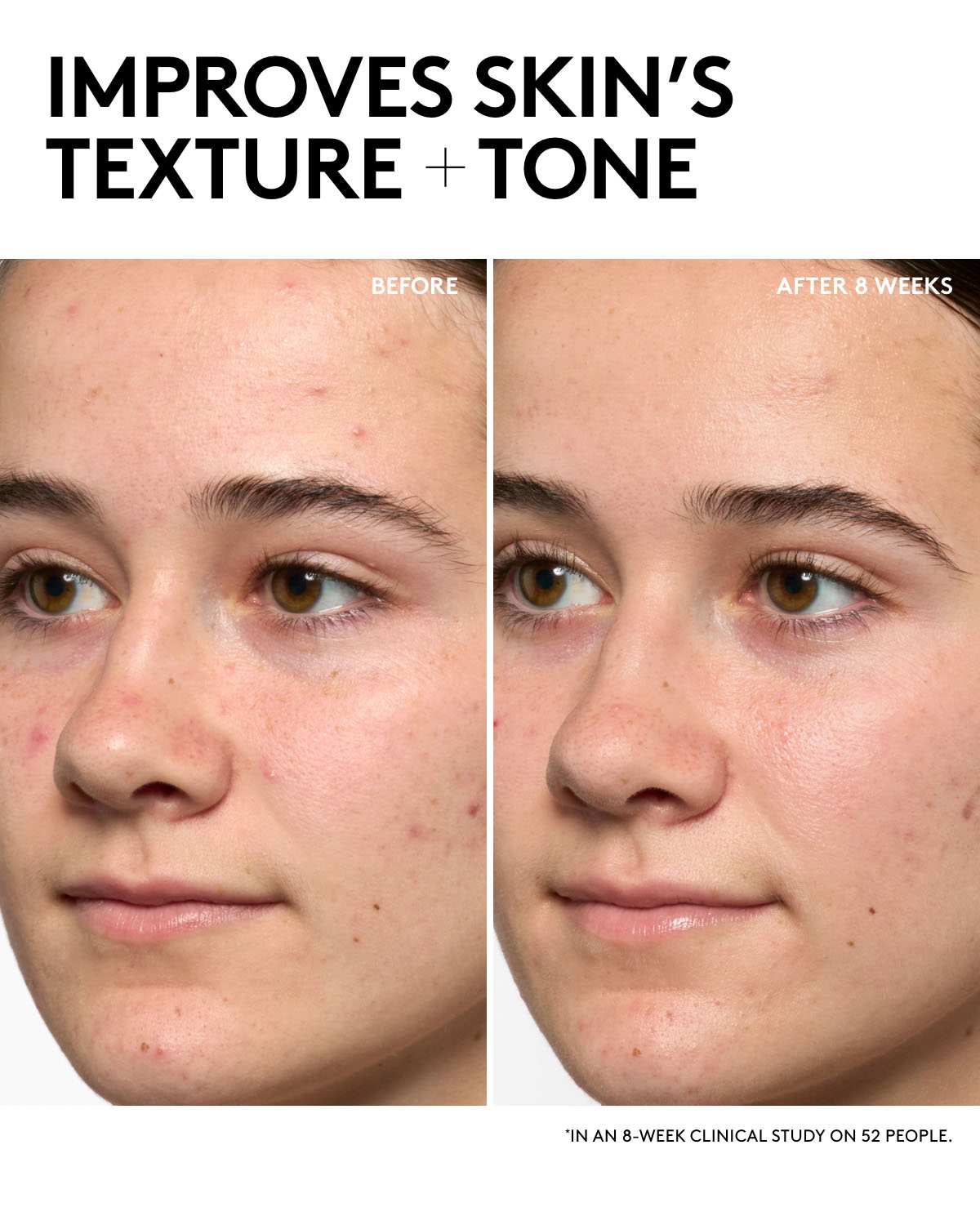 Hydra Vizor Invisible Moisturizer Broad Spectrum SPF 30 Sunscreen with Niacinamide + Kalahari Melon